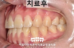수술후