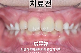 수술전