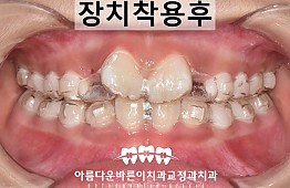 수술후