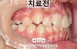수술전