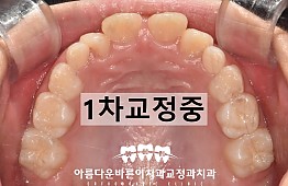수술후