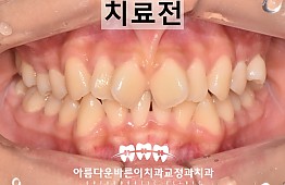 수술전