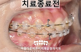 수술후