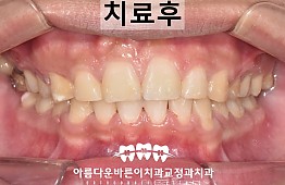 수술후