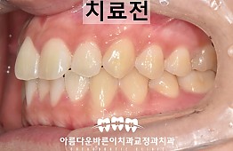 수술전