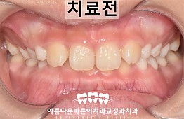 수술전
