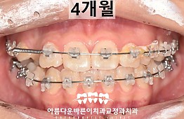 수술후