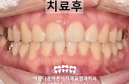 수술후