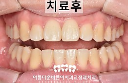 수술후