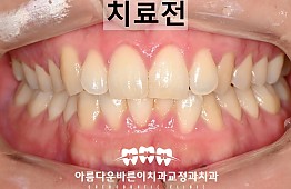 수술전