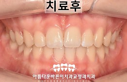 수술후