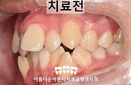 수술전