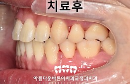수술후