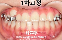 수술후