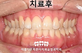 수술후