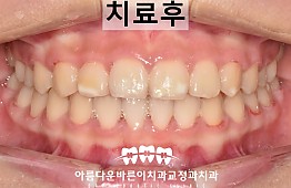 수술후