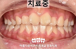 수술전