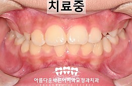 수술후
