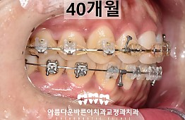 수술후