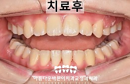 수술후
