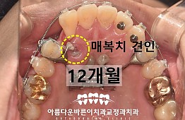 수술후