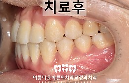 수술후