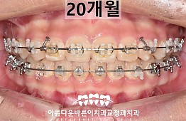 수술후