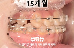 수술후