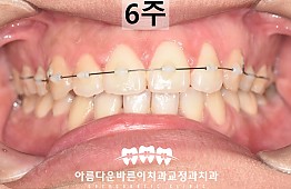 수술후