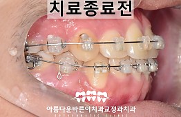 수술후