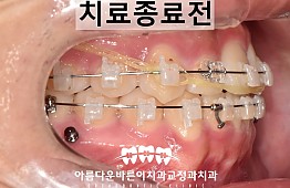 수술후