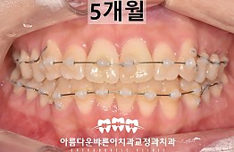 수술후