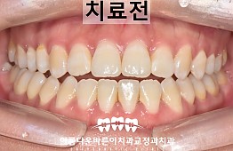 수술전