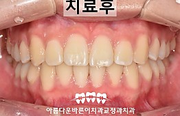 수술후