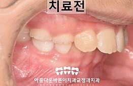수술전
