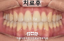 수술후