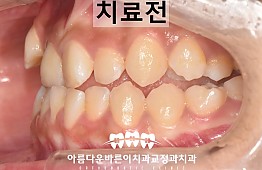 수술전