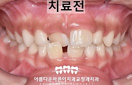 수술전