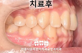 수술전