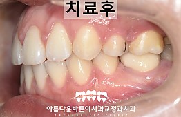 수술후