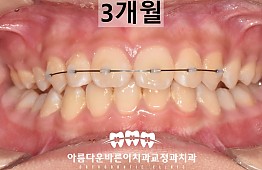수술후