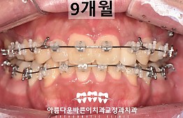 수술후