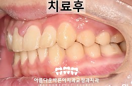 수술후