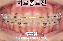 수술후