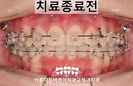 수술후