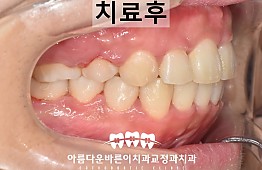 수술후