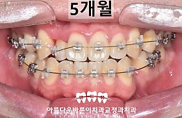 수술후