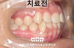 수술전