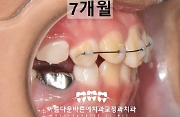 수술후
