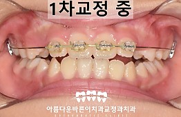 수술후